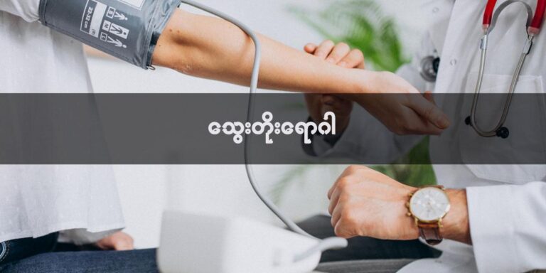 Blog-3